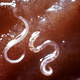 Image for article titled Why doctors are treating allergies with parasitic worms